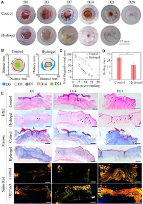 Highly Adhesive Antibacterial Bioactive Composite Hydrogels With Controllable Flexibility and Swelling as Wound Dressing for Full-Thickness Skin Healing